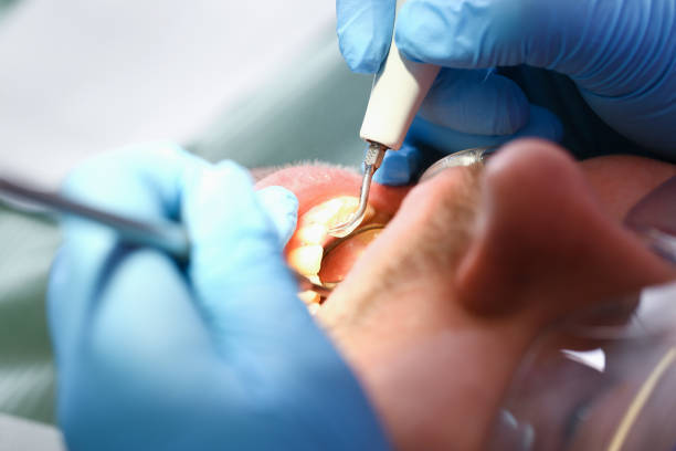 Professional Emergency Dental Service in OR